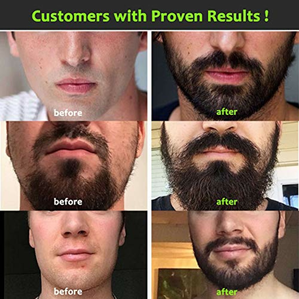 Beard Growth Kit Complete Beard Grooming Kit for Men with Titanium