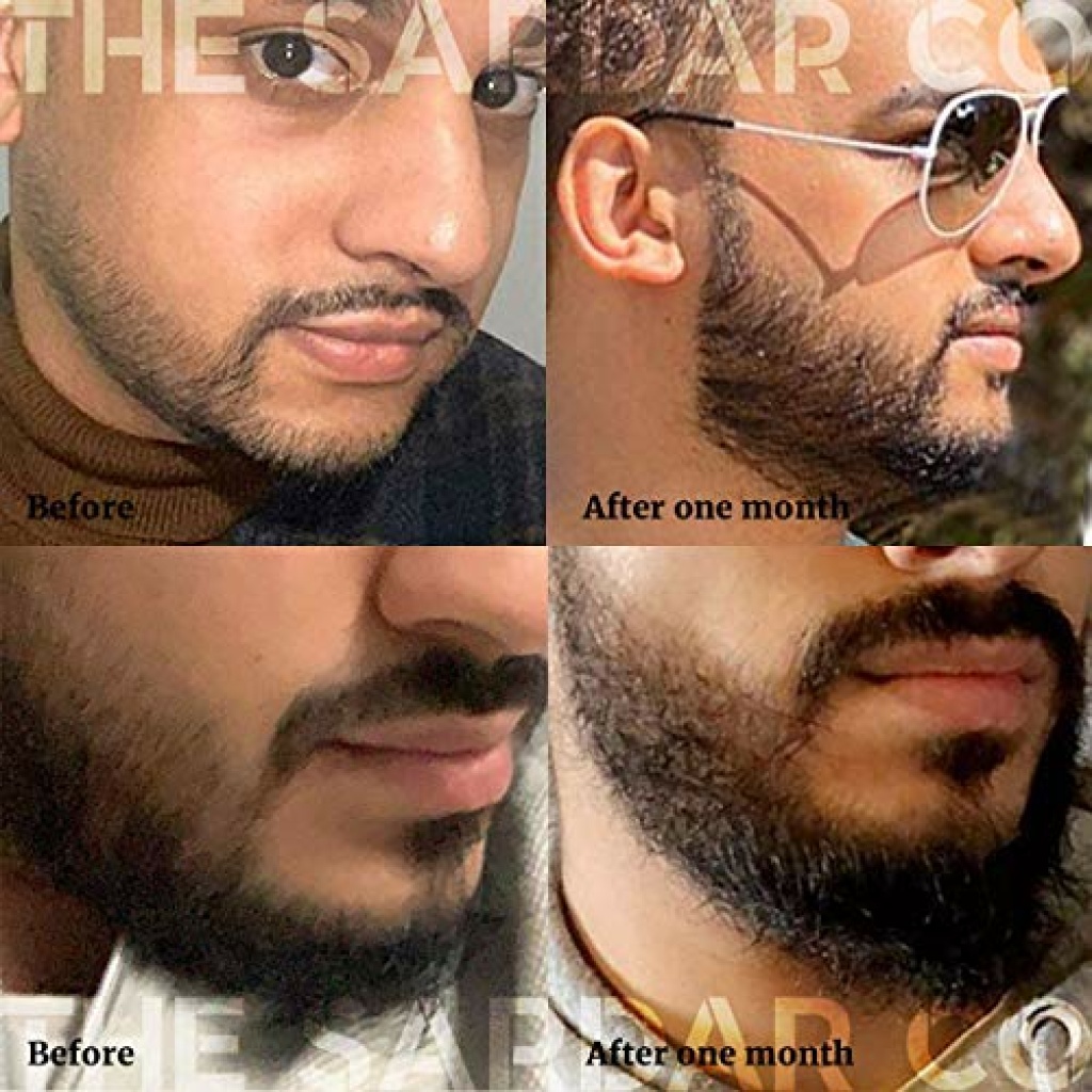 Derma Roller for Hair & Beard Growth Titanium Micro Needling Roller 0