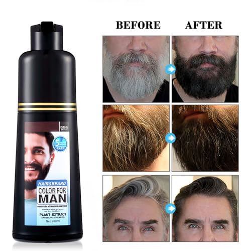 Mens-Mustache-Beard-Dye-for-Gray-Hair-Coverage-Natural-Black-Color-in-5-Minutes-Easy-Application-Shampoo-for-Facial-Hair-200ml-0-0
